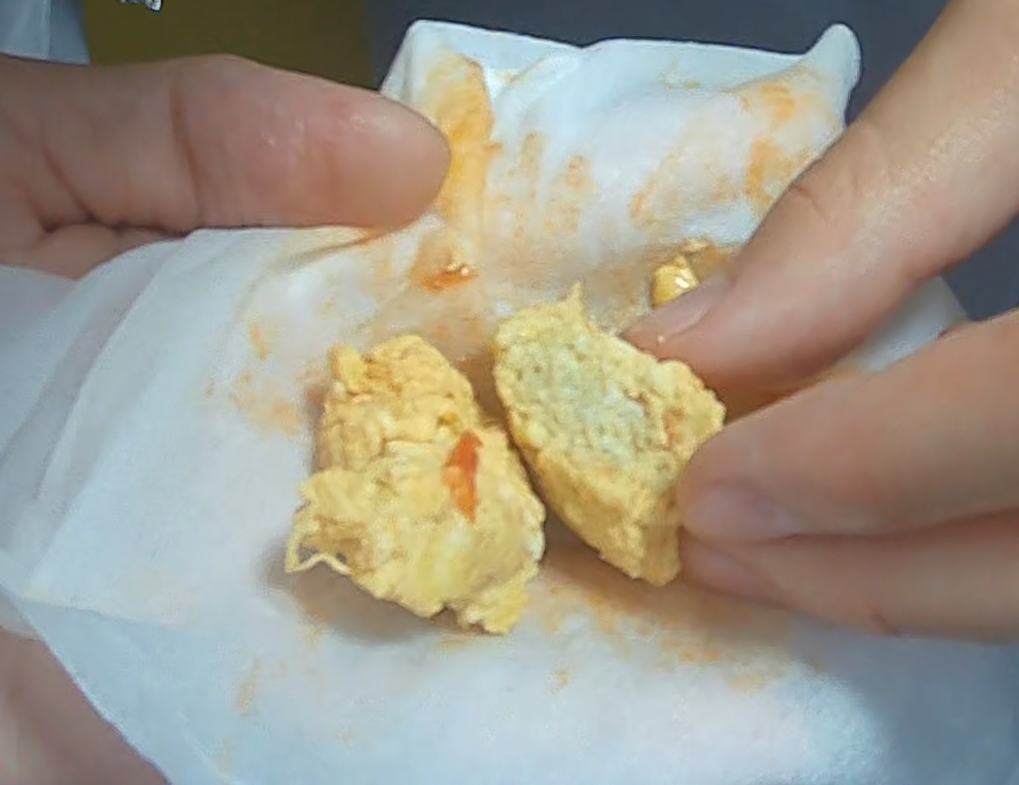 北京二中分校西红柿鸡蛋中吃出绿色鸡蛋